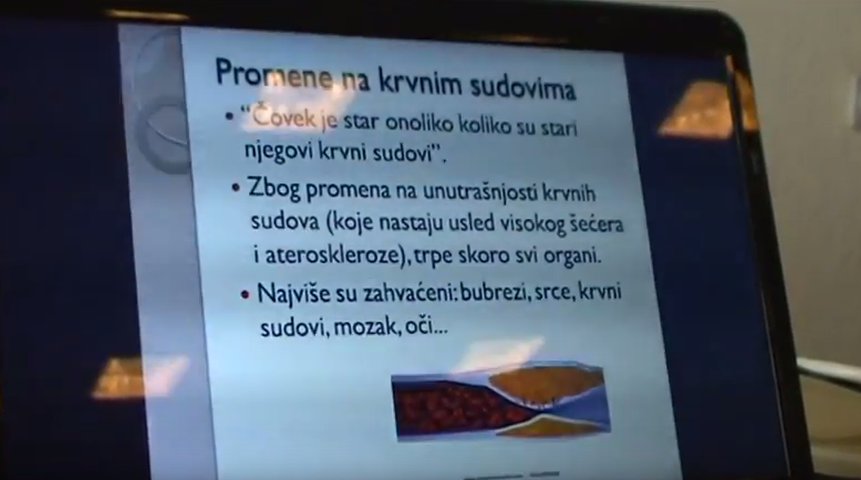 Предавање „Дијабетес у Србији и свету“
