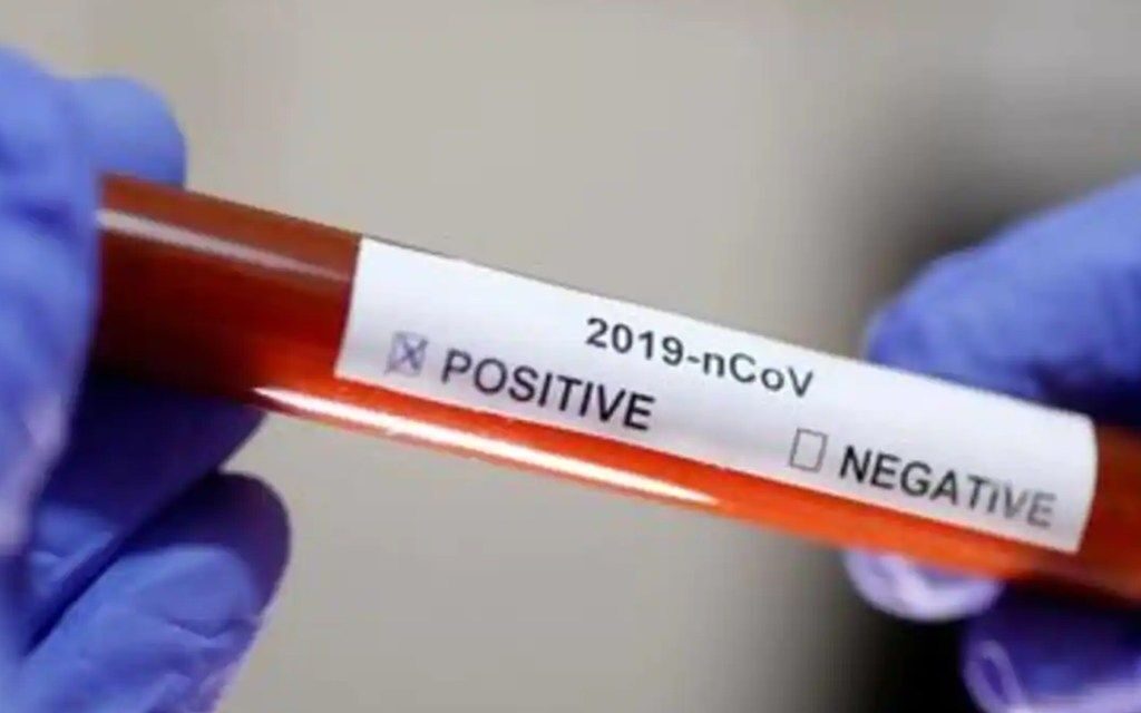 ВИШЕ ОД ПОЛОВИНЕ КОВИД ПАЦИЈЕНАТА ЈЕ ИЗ ЋУПРИЈЕ