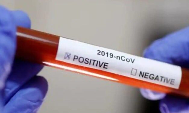 ВИШЕ ОД ПОЛОВИНЕ КОВИД ПАЦИЈЕНАТА ЈЕ ИЗ ЋУПРИЈЕ