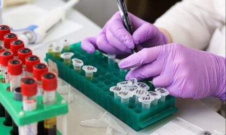 ИЗВЕШТАЈ О РАДУ КОВИД АМБУЛАНТИ ЗА 8. ДЕЦЕМБАР