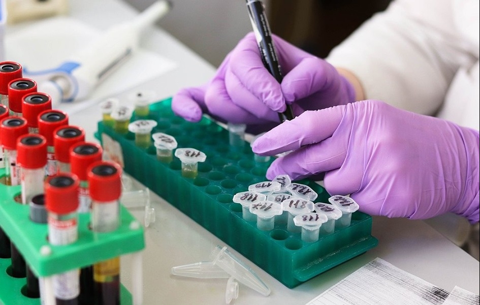 ИЗВЕШТАЈ О РАДУ КОВИД АМБУЛАНТИ ЗА 8. ДЕЦЕМБАР